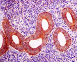 Immunohistochemistry (Formalin/PFA-fixed paraffin-embedded sections) - Anti-Rho guanine exchange factor 16/NBR antibody [EPR9950] (AB154785)