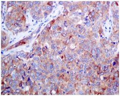 Immunohistochemistry (Formalin/PFA-fixed paraffin-embedded sections) - Anti-Rho guanine exchange factor 16/NBR antibody [EPR9950] (AB154785), expandable thumbnail