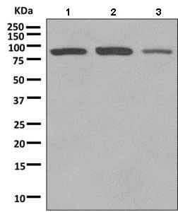 Western blot - Anti-Rho guanine exchange factor 16/NBR antibody [EPR9950] (AB154785), expandable thumbnail