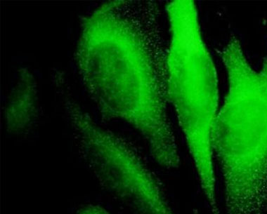 Immunocytochemistry/ Immunofluorescence - Anti-RhoA antibody [1B12] (AB54835)