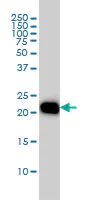 Western blot - Anti-RhoA antibody [1B12] (AB54835)