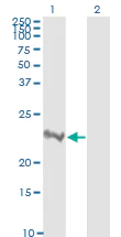 Western blot - Anti-RhoA antibody [1B12] (AB54835)