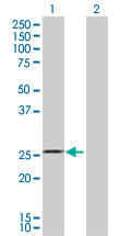 Western blot - Anti-RhoA antibody (AB167551)