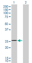 Western blot - Anti-RhoA antibody (AB167551)