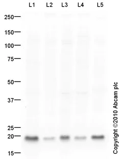 Western blot - Anti-RhoA antibody (AB86297)