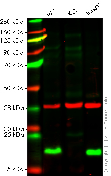 Western blot - Anti-RhoA antibody [EPR18134] (AB187027), expandable thumbnail
