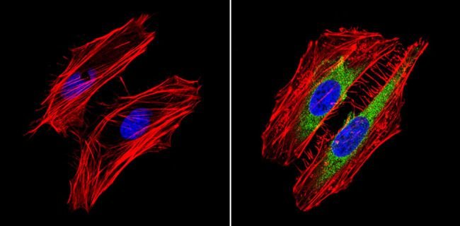 Immunocytochemistry/ Immunofluorescence - Anti-RhoA + C antibody [1B34A10] (AB175359), expandable thumbnail