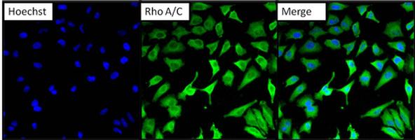 Immunocytochemistry/ Immunofluorescence - Anti-RhoA + C antibody [1B34A10] (ab175359), expandable thumbnail