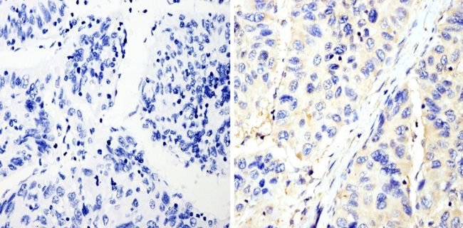 Immunohistochemistry (Formalin/PFA-fixed paraffin-embedded sections) - Anti-RhoA + C antibody [1B34A10] (AB175359), expandable thumbnail