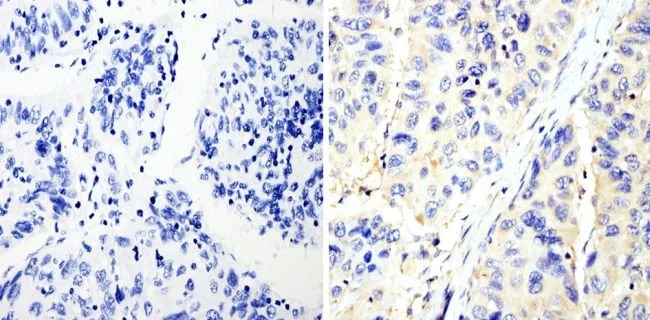 Immunohistochemistry (Formalin/PFA-fixed paraffin-embedded sections) - Anti-RhoA + C antibody [1B34A10] (AB175359)