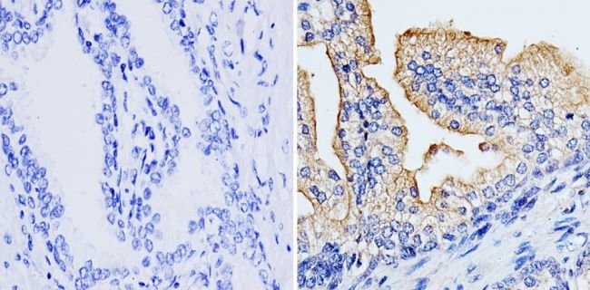 Immunohistochemistry (Formalin/PFA-fixed paraffin-embedded sections) - Anti-RhoA + C antibody [1B34A10] (ab175359), expandable thumbnail