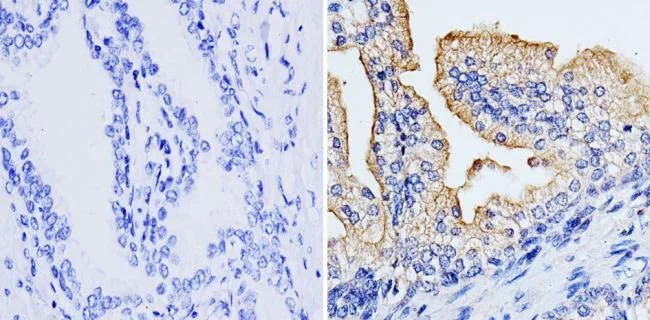 Immunohistochemistry (Formalin/PFA-fixed paraffin-embedded sections) - Anti-RhoA + C antibody [1B34A10] (AB175359)