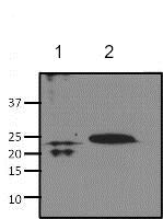 Immunoprecipitation - Anti-RhoA + C antibody [1B34A10] (ab175359), expandable thumbnail