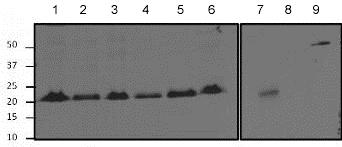 Western blot - Anti-RhoA + C antibody [1B34A10] (ab175359), expandable thumbnail