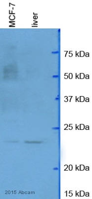 Western blot - Anti-RhoA (phospho S188) antibody (AB41435)