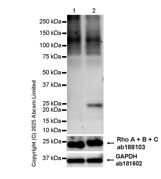 Western blot - Anti-RhoA + RhoB (ADP-ribosylated) antibody [VIF140-A1] - Mouse IgG2a (Chimeric) - BSA & Azide free (AB324244)
