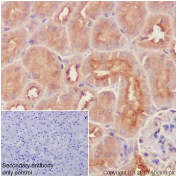 Immunohistochemistry (Formalin/PFA-fixed paraffin-embedded sections) - Anti-RhoA + RhoC antibody [EPR18133] - BSA and Azide free (AB238943)