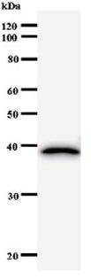 Western blot - Anti-RHOB antibody [2916C2a] (AB53743)
