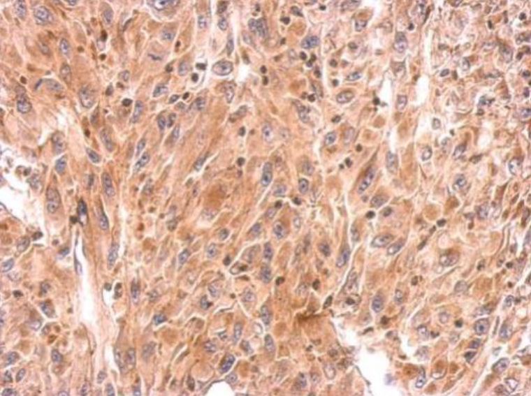 Immunohistochemistry (Formalin/PFA-fixed paraffin-embedded sections) - Anti-RHOB antibody (AB155149), expandable thumbnail