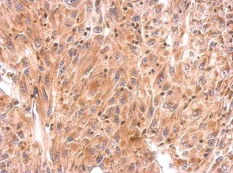 Immunohistochemistry (Formalin/PFA-fixed paraffin-embedded sections) - Anti-RHOB antibody (AB155149)