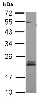 Western blot - Anti-RHOB antibody (AB155149), expandable thumbnail