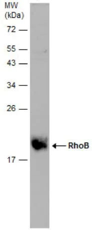 Western blot - Anti-RHOB antibody (AB155149)