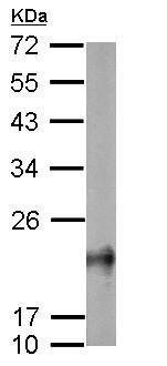Western blot - Anti-RHOB antibody (AB155149), expandable thumbnail