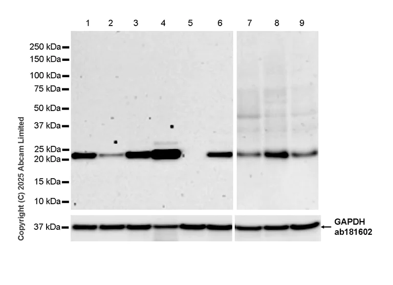 Western blot - Anti-RHOB antibody [EPR30502-160] (AB325531)