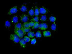 Immunocytochemistry/ Immunofluorescence - Anti-RHOBTB1 antibody [EPR8990] (AB150408)