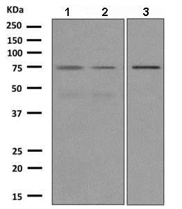 Western blot - Anti-RHOBTB1 antibody [EPR8990] (AB150408)