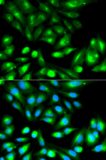 Immunocytochemistry/ Immunofluorescence - Anti-RHOC antibody (AB180785)