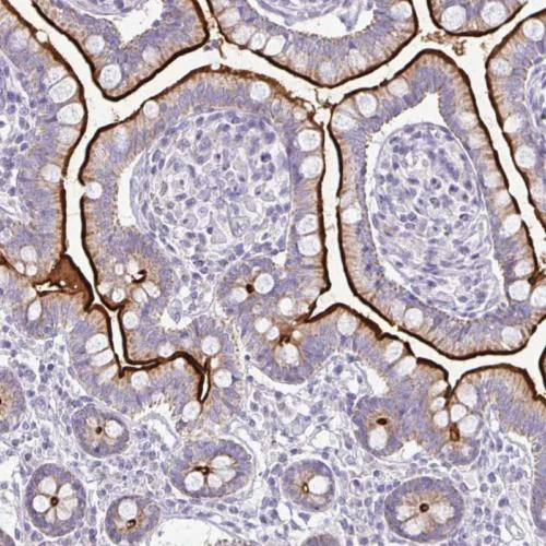 Immunohistochemistry (Formalin/PFA-fixed paraffin-embedded sections) - Anti-RHOC antibody (AB204312)