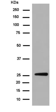 Western blot - Anti-RHOD antibody [EPR7027] - BSA and Azide free (AB250810)