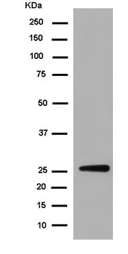 Western blot - Anti-RHOD antibody [EPR7027] - N-terminal (AB185211)