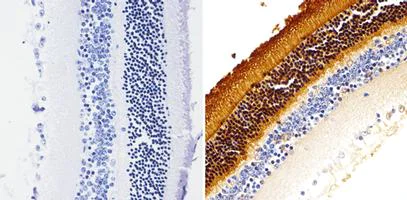 Immunohistochemistry (Formalin/PFA-fixed paraffin-embedded sections) - Anti-Rhodopsin antibody [1D4] (AB5417)
