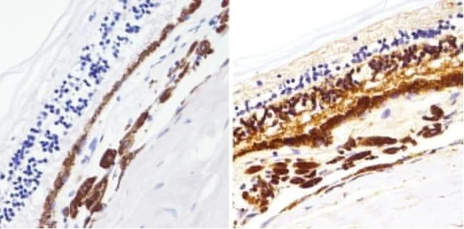 Immunohistochemistry (Formalin/PFA-fixed paraffin-embedded sections) - Anti-Rhodopsin antibody [1D4] (AB5417)