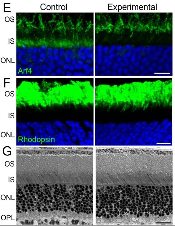Immunohistochemistry (Formalin/PFA-fixed paraffin-embedded sections) - Anti-Rhodopsin antibody [1D4] (AB5417)