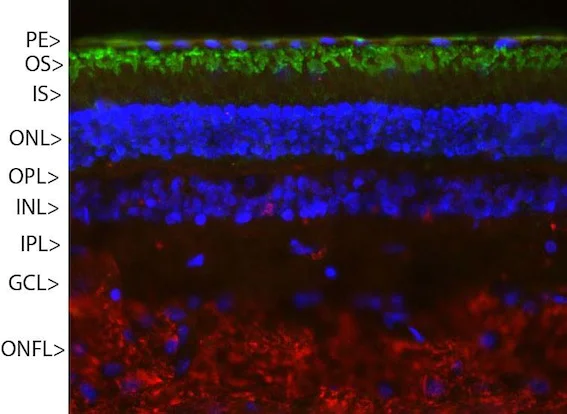 Immunocytochemistry/ Immunofluorescence - Anti-Rhodopsin antibody [A531] (AB190307)
