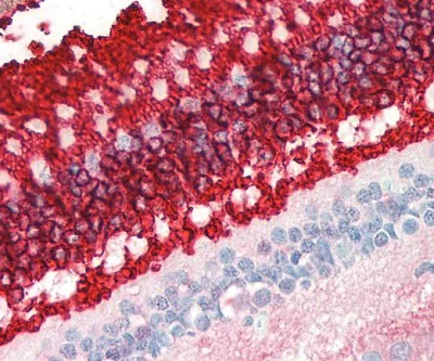 Immunohistochemistry (Formalin/PFA-fixed paraffin-embedded sections) - Anti-Rhodopsin antibody [B630] (AB230692)