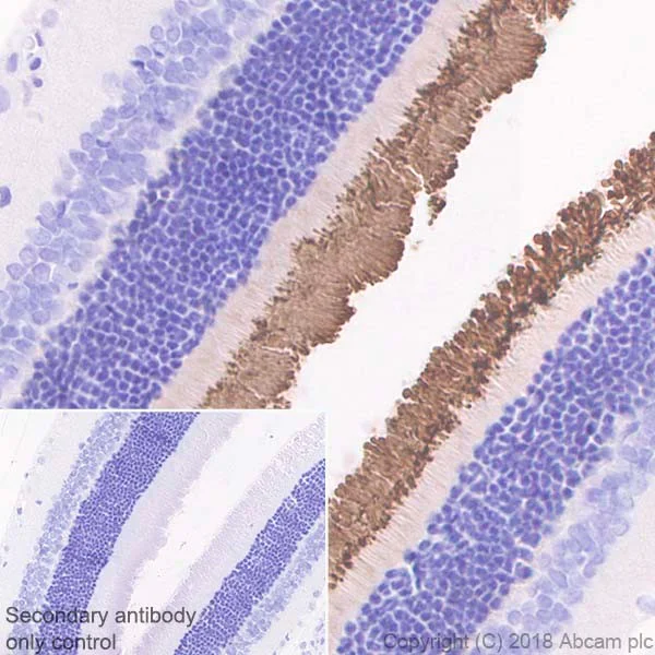 Immunohistochemistry (Formalin/PFA-fixed paraffin-embedded sections) - Anti-Rhodopsin antibody [EPR21876] (AB221664)