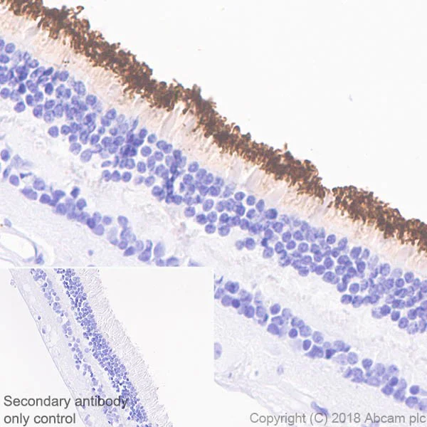 Immunohistochemistry (Formalin/PFA-fixed paraffin-embedded sections) - Anti-Rhodopsin antibody [EPR21876] (AB221664)