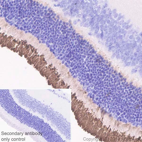 Immunohistochemistry (Formalin/PFA-fixed paraffin-embedded sections) - Anti-Rhodopsin antibody [EPR21876] (AB221664)