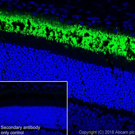 Immunohistochemistry (Frozen sections) - Anti-Rhodopsin antibody [EPR21876] (AB221664)