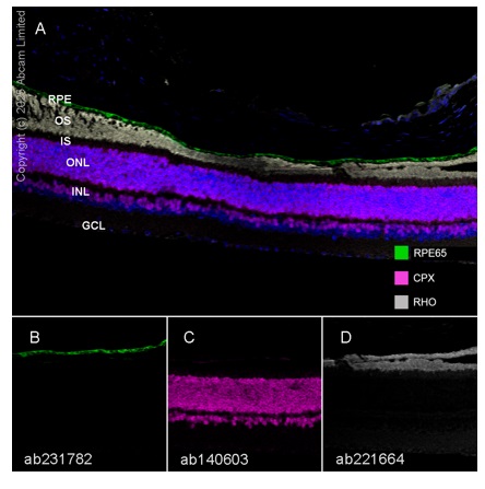 Multiplex immunohistochemistry - Anti-Rhodopsin antibody [EPR21876] (AB221664)