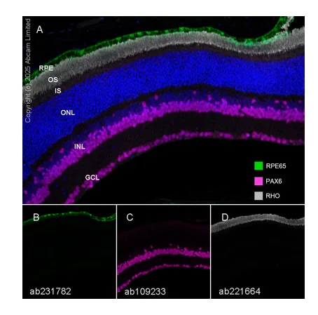 Multiplex immunohistochemistry - Anti-Rhodopsin antibody [EPR21876] - BSA and Azide free (AB232934)