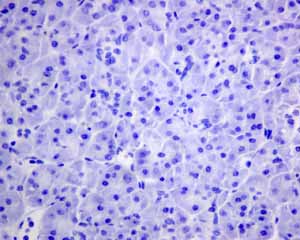 Immunohistochemistry (Formalin/PFA-fixed paraffin-embedded sections) - Anti-Rhodopsin antibody [EPR7996] (AB155097)