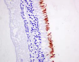 Immunohistochemistry (Formalin/PFA-fixed paraffin-embedded sections) - Anti-Rhodopsin antibody [EPR7996] - BSA and Azide free (AB249189)