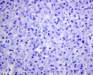 Immunohistochemistry (Formalin/PFA-fixed paraffin-embedded sections) - Anti-Rhodopsin antibody [EPR7996] - BSA and Azide free (AB249189)