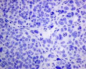 Immunohistochemistry (Formalin/PFA-fixed paraffin-embedded sections) - Anti-Rhodopsin antibody [EPR7996] - BSA and Azide free (AB249189)