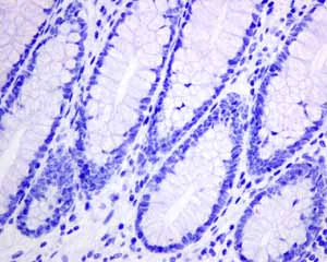 Immunohistochemistry (Formalin/PFA-fixed paraffin-embedded sections) - Anti-Rhodopsin antibody [EPR7996] - BSA and Azide free (AB249189)